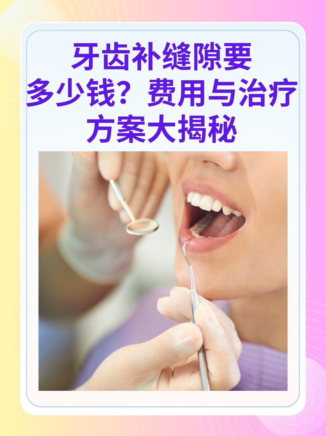 开封补牙医保可以报销吗(补牙医保可以报销吗 哪些可以报销呢)